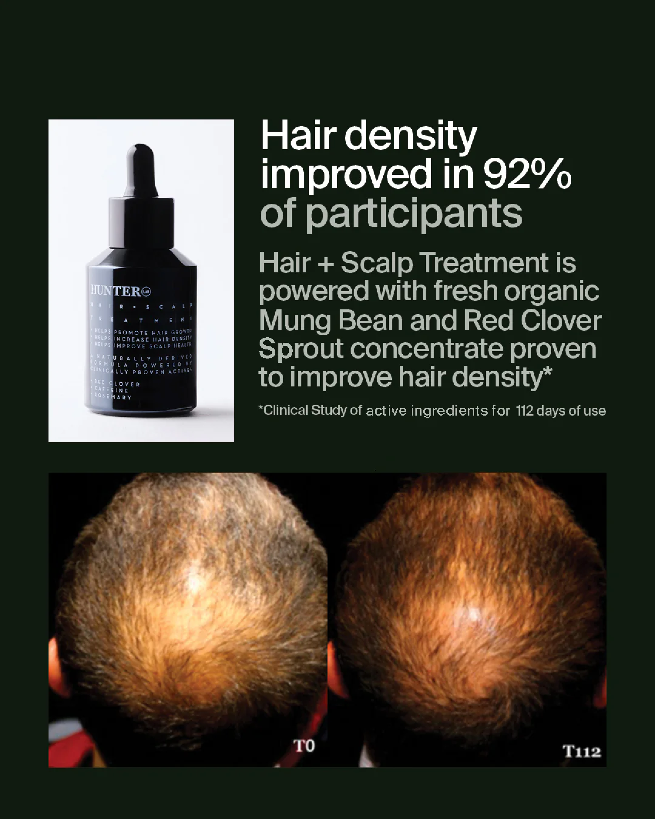 Hair + Scalp Treatment