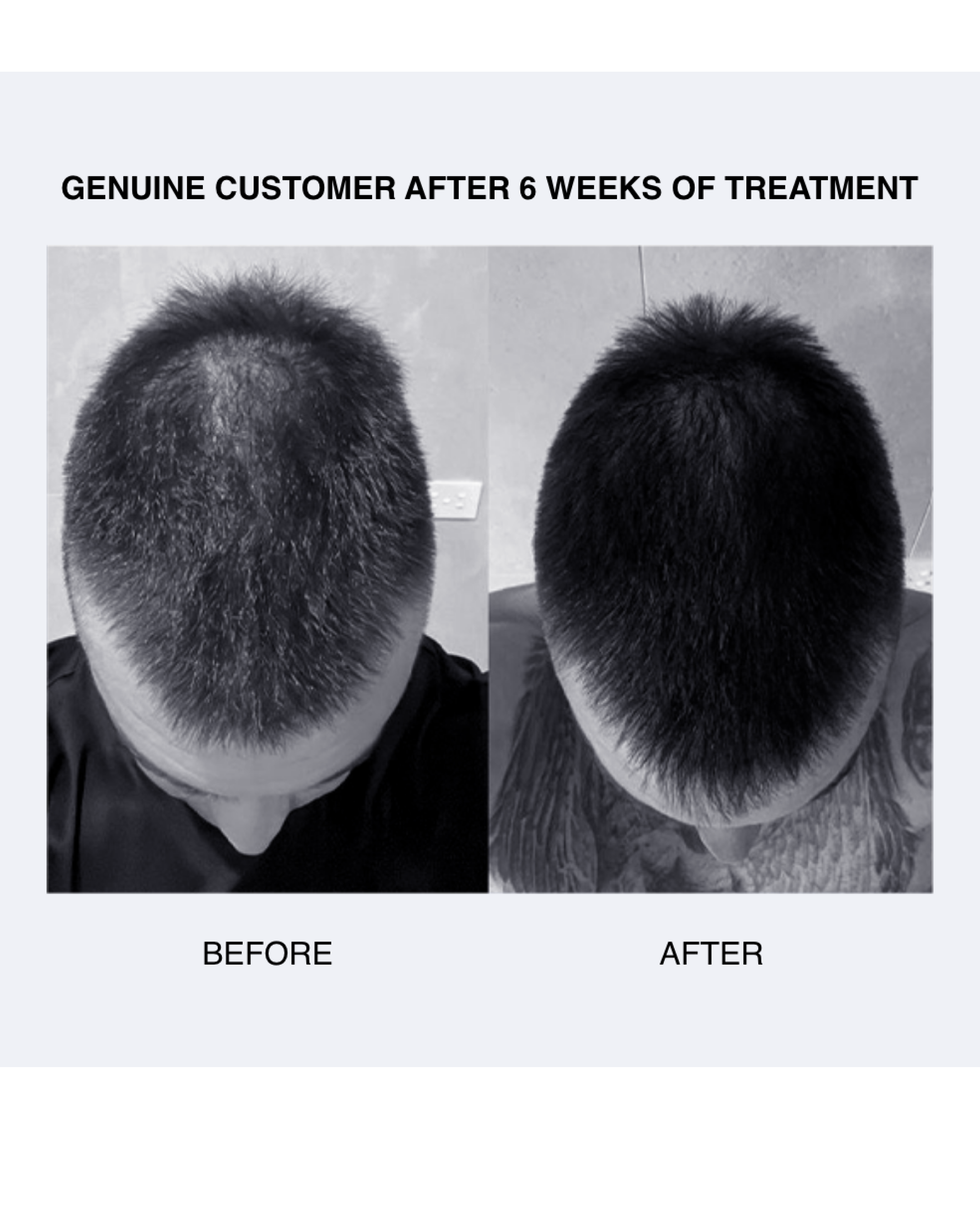 CD Plus Ultra Thickening Anti-Hair Loss Conditioner